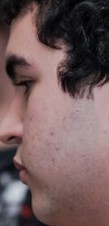 Face of SkyBart