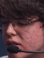 Face of Jockster