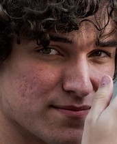 Face of micaO