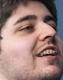 Face of Skyer