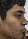 Face of Zirigui