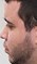 Face 3