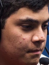 Face of Zirigui
