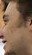 Face 5