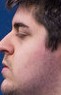 Face of Skyer