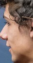 Face 3