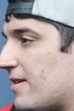 Face of brTT