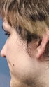 Face 3