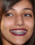 Face 1