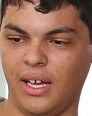 Face 1