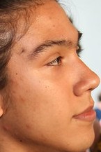 Face 5