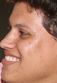 Face 6
