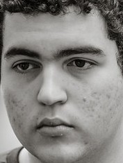 Face of SkyBart