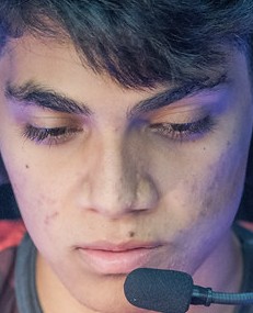 Face of Zirigui