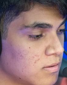 Face of Zirigui