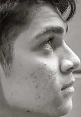 Face of Zirigui