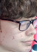 Face of Lep