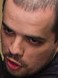 Face 1