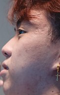 Face of Yang