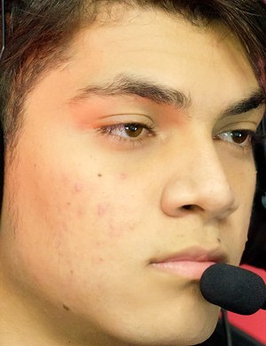 Face of Zirigui