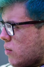 Face of Jockster