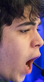 Face of Fitz