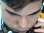 Face of RedBert