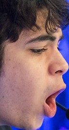 Face of Fitz
