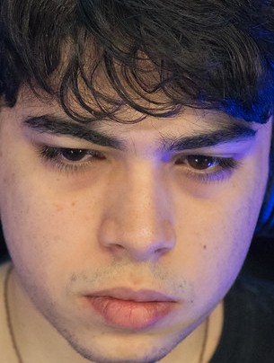 Face of Fitz