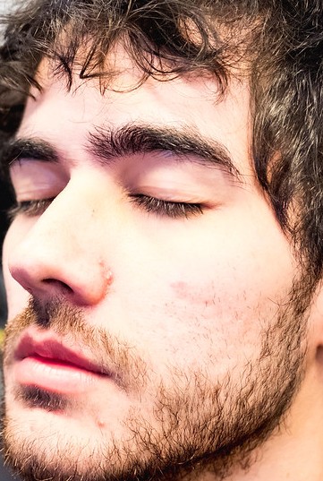 Face of Zantins