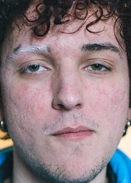 Face of micaO