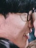 Face of ADD