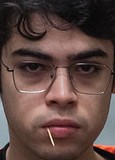 Face of Fitz