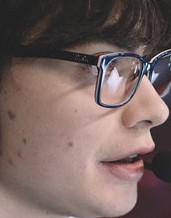Face of Lep
