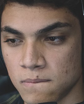 Face of Zirigui