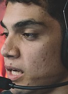 Face of Zirigui