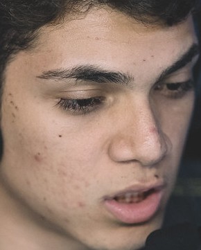 Face of Zirigui