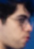 Face of Fitz
