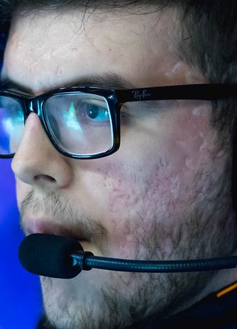 Face of Jockster