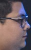 Face of esA