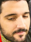 Face of brTT