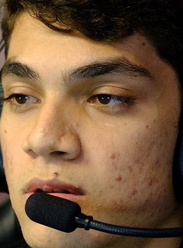 Face of Zirigui