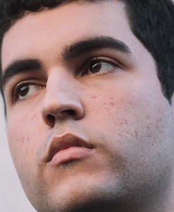 Face of SkyBart