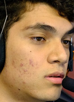 Face of Zirigui