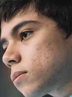 Face of pbO