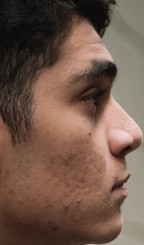 Face of Zirigui