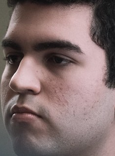 Face of SkyBart