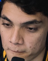 Face of Zirigui