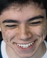Face of pbO