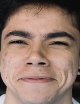 Face of pbO